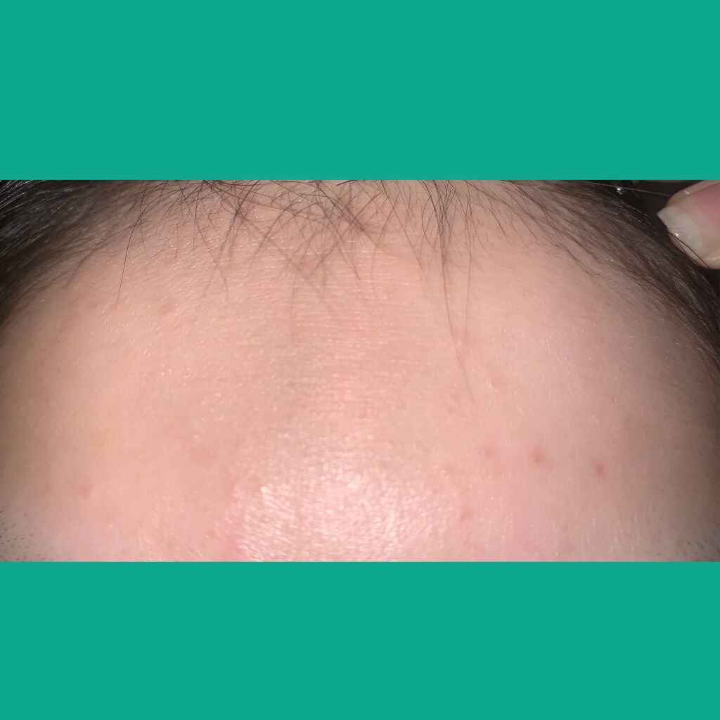 明色美顔水 薬用化粧水/美顔/化粧水を使ったクチコミ(2枚目)