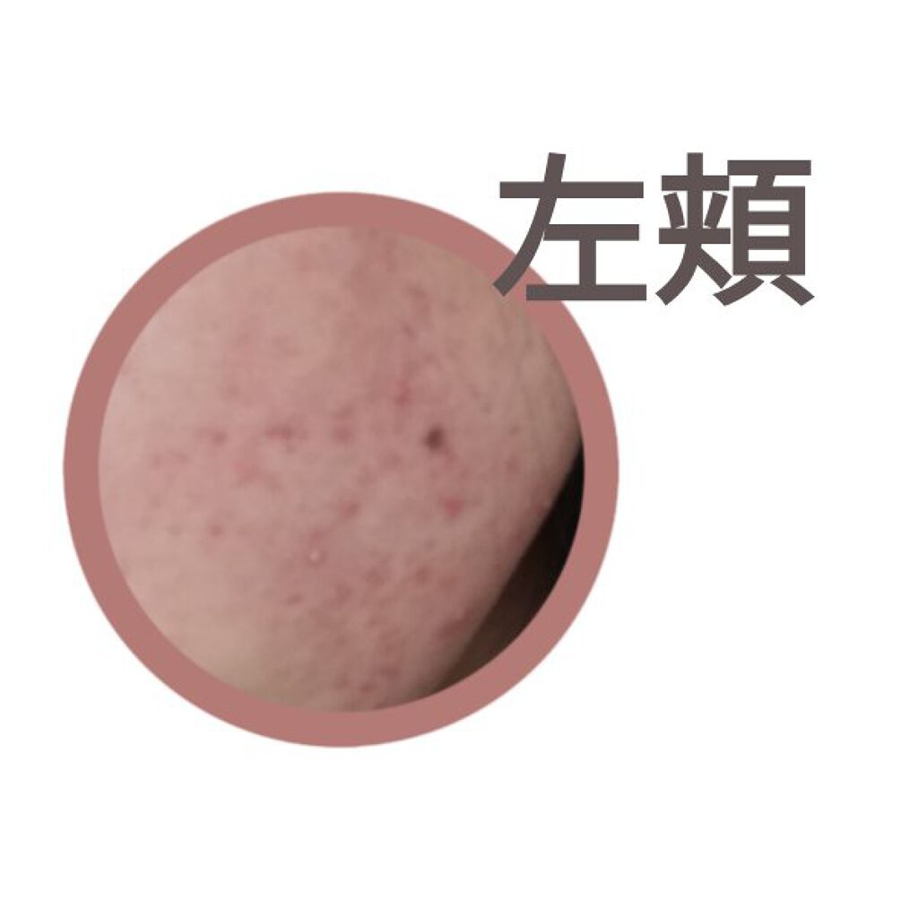 ハトムギ化粧水(ナチュリエ スキンコンディショナー R )/ナチュリエ/化粧水を使ったクチコミ（3枚目）