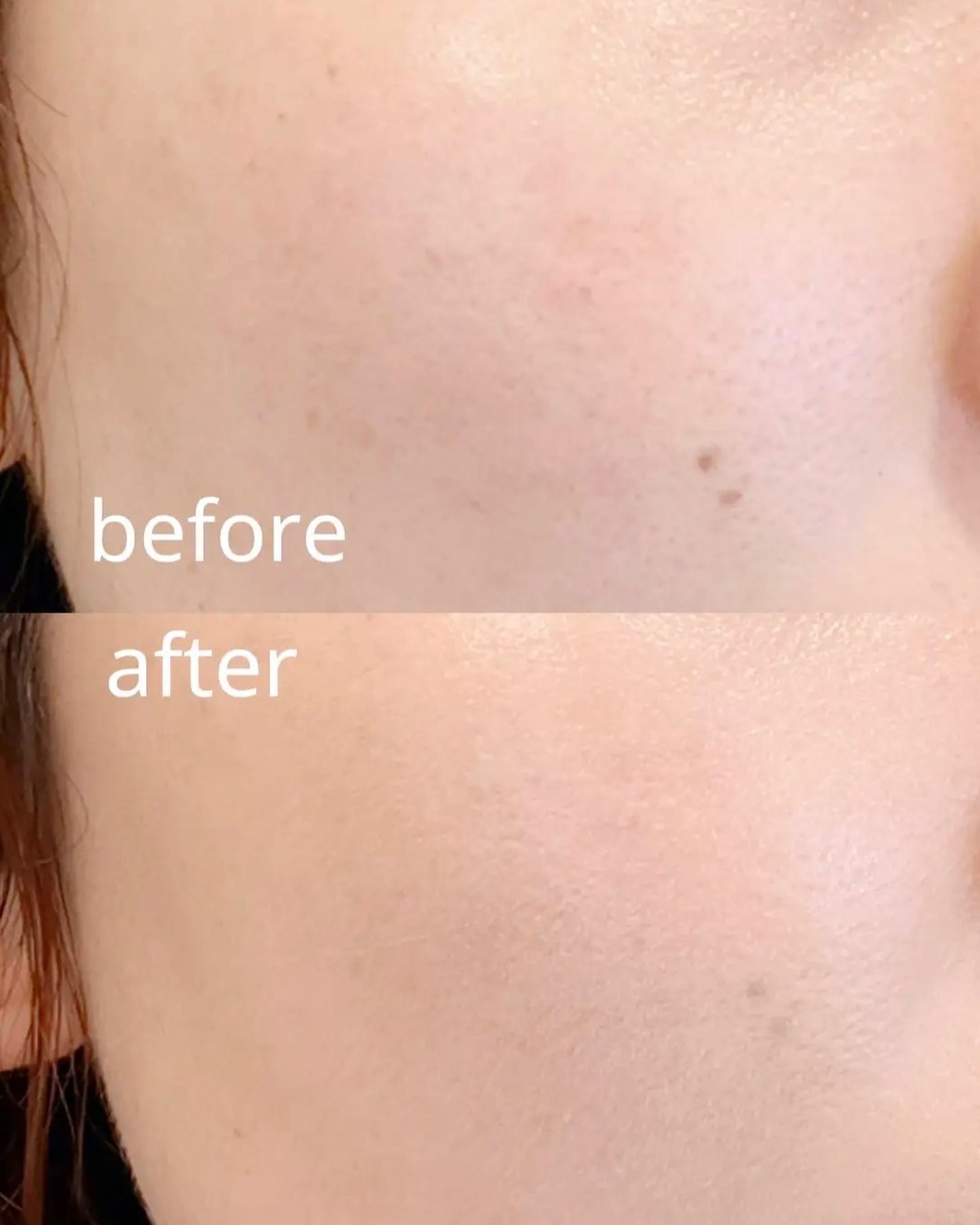 薬用クリアエステヴェールEX/Macchia Label/リキッドファンデーションを使ったクチコミ(5枚目)