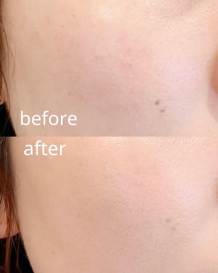 薬用クリアエステヴェールEX/Macchia Label/リキッドファンデーションを使ったクチコミ(5枚目)