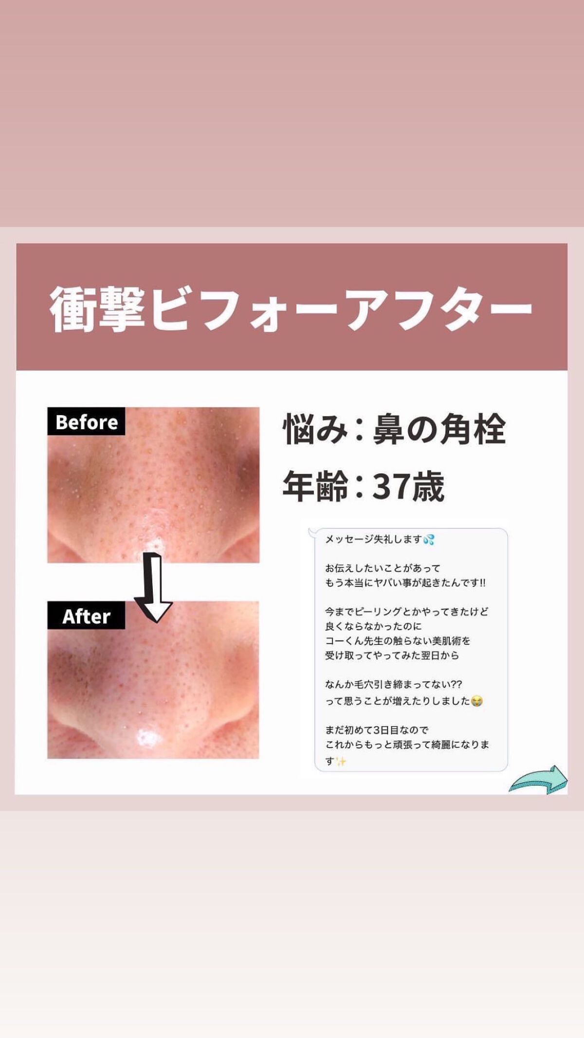 を使ったクチコミ（2枚目）