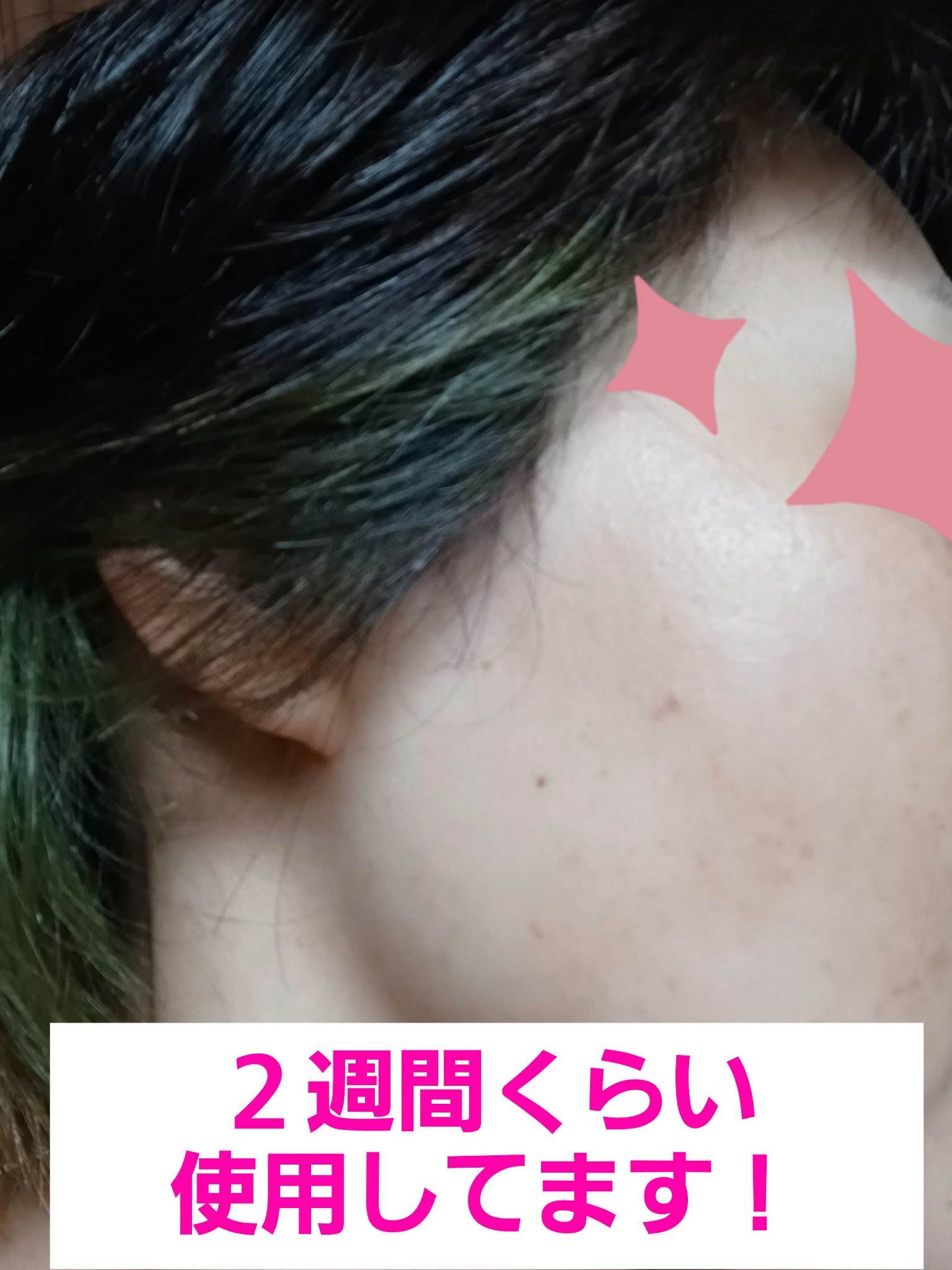 ミルクブライトニングトナー/MEDIHEAL/化粧水を使ったクチコミ（2枚目）