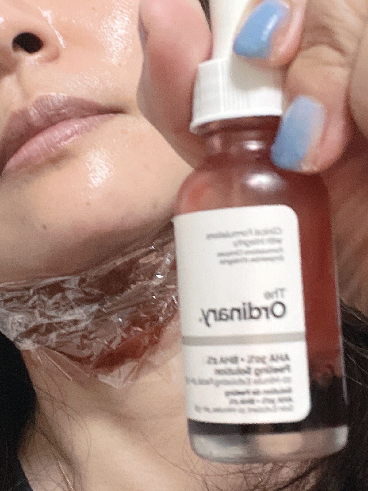 AHA 30% + BHA 2% Peeling Solution/The Ordinary/ピーリングを使ったクチコミ(2枚目)