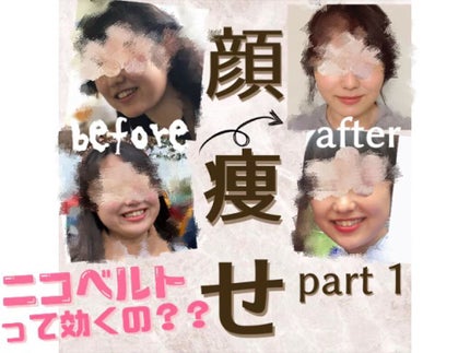 NICOBELT(ニコベルト)/VONMIE/美顔器・マッサージを使ったクチコミ(1枚目)