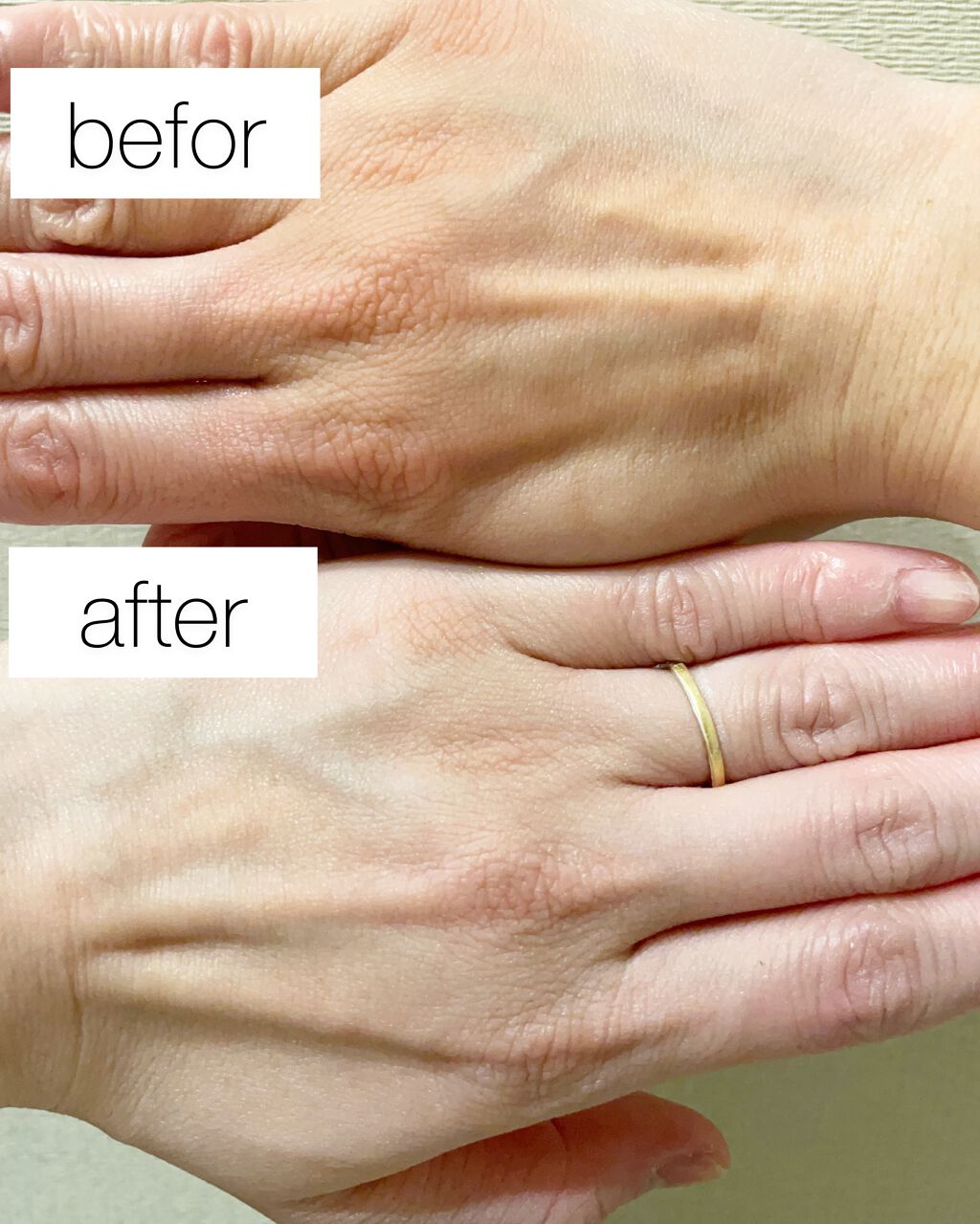 デュイセル ターンオンクリーム/DEWYCEL/フェイスクリームを使ったクチコミ（3枚目）