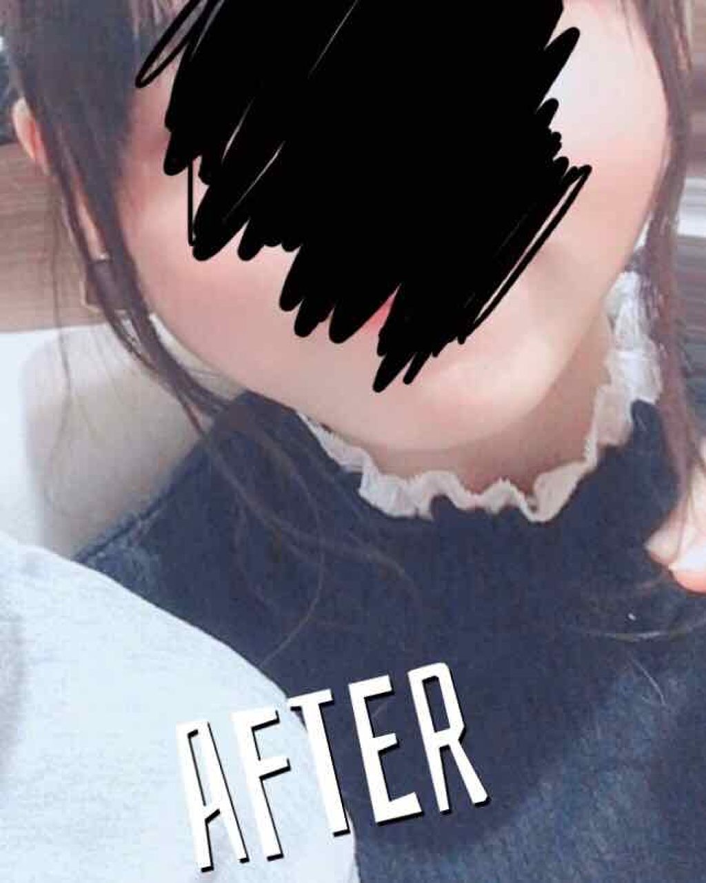 ハトムギ化粧水(ナチュリエ スキンコンディショナー R )/ナチュリエ/化粧水を使ったクチコミ（3枚目）