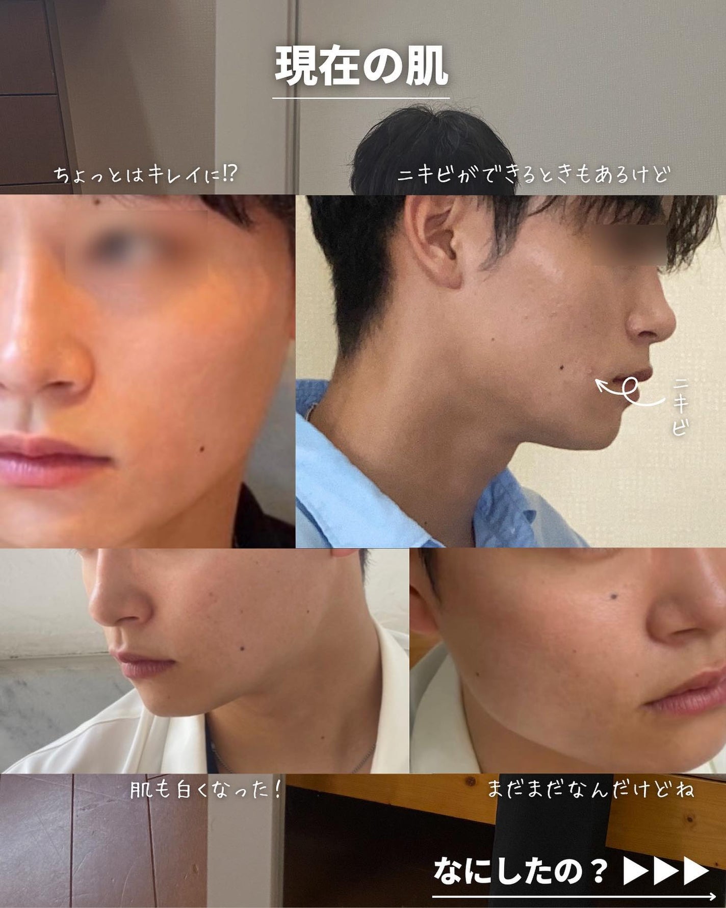 こーき@20代の垢抜け美容 on LIPS 「@kooki_mensskincare◀︎垢抜けたいメンズはこ..」(4枚目)