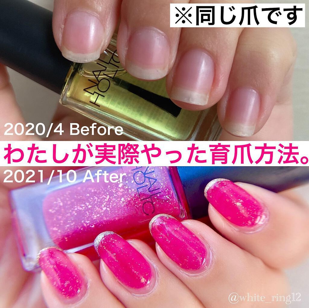 ネイルエンビー/O・P・I/ネイルオイル・トリートメントを使ったクチコミ（1枚目）