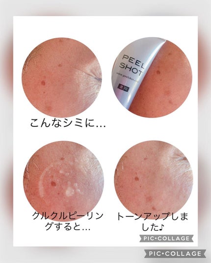 ピールショット/北の快適工房/ピーリングを使ったクチコミ(4枚目)