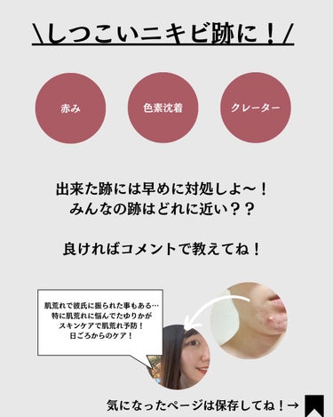 innisfree ビタC　グリーンティーエンザイム　ブライト　セラムのクチコミ「@yurika_nikibi.care 👈他の投稿はコチラ✨️

〈ニキビ跡ルーティン✨️.....」（2枚目）