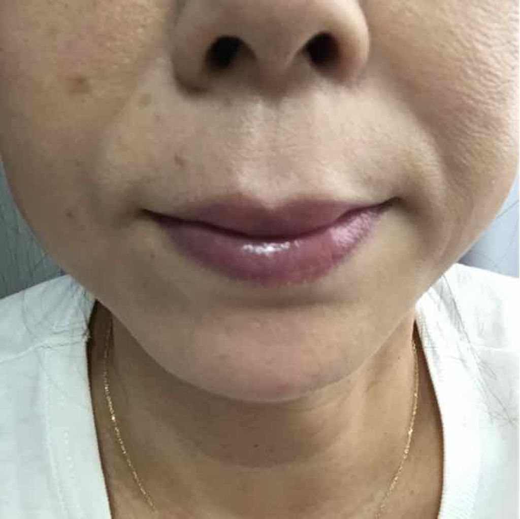 ダイヤモンドライト マルチユース ハイライター/Too Faced/パウダーハイライトを使ったクチコミ（3枚目）