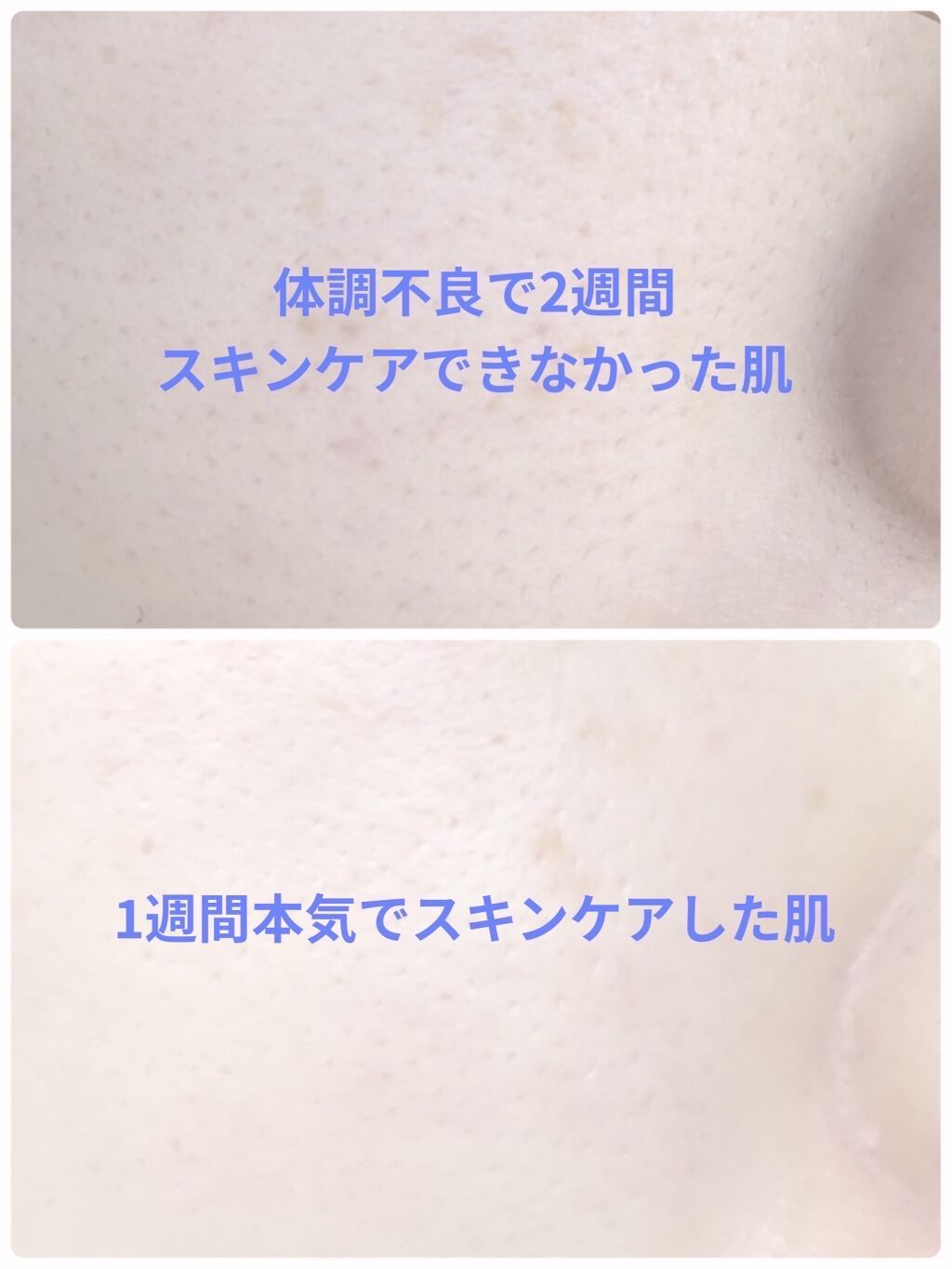 ティーツリーケアソリューション アンプルマスクJEX/MEDIHEAL/シートマスク・パックを使ったクチコミ（1枚目）