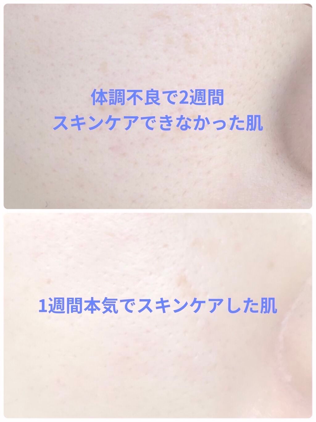 ティーツリーケアソリューション アンプルマスクJEX/MEDIHEAL/シートマスク・パックを使ったクチコミ(1枚目)