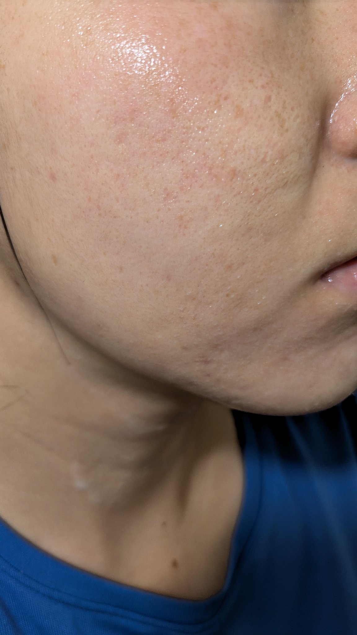 A2+NAG2ソリューション/The Ordinary/美容液を使ったクチコミ（1枚目）