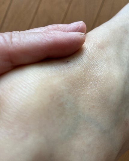 NONON/NONON(ノンノン)/除毛クリームを使ったクチコミ(5枚目)