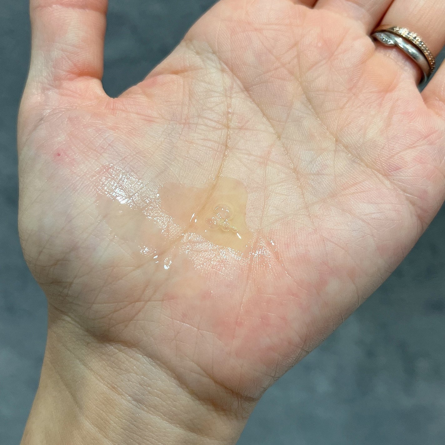 Ultra Whitening Perfect Ampoule/MIGUHARA/美容液を使ったクチコミ(5枚目)