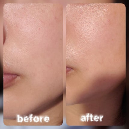 クリアアップローション 2 e/IPSA/化粧水を使ったクチコミ(2枚目)