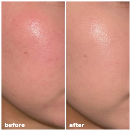 ハイパーメッシュファンデーション/LUNA/クッションファンデーションを使ったクチコミ(4枚目)