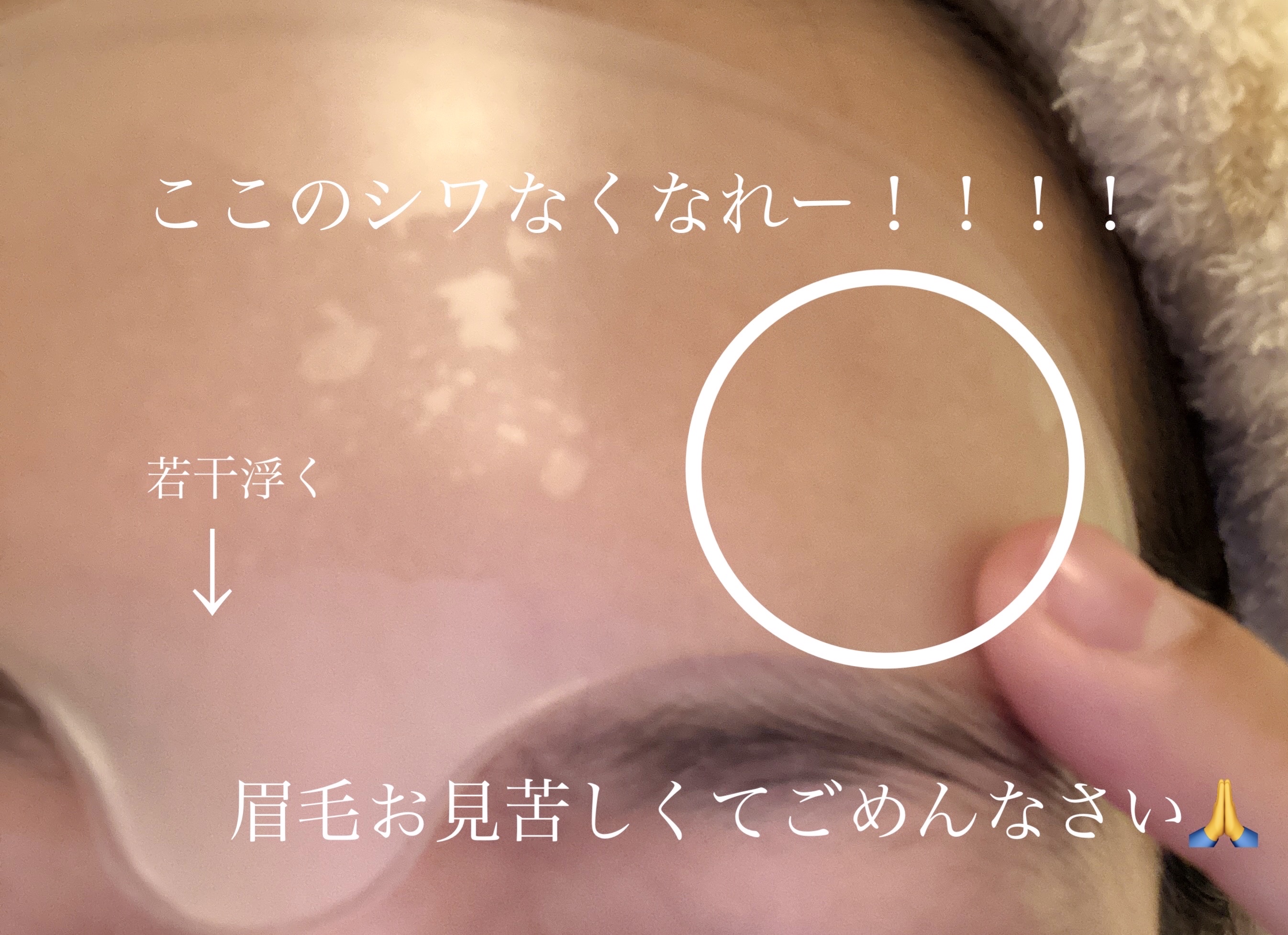 おでこでシワ取りパッチ/株式会社オントリス/その他を使ったクチコミ（3枚目）