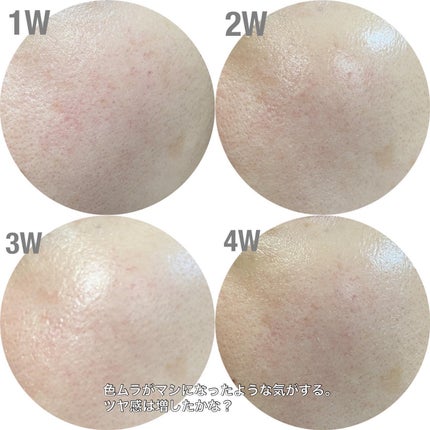 ビタペアCデイリーシートマスク/ネイチャーリパブリック/シートマスク・パックを使ったクチコミ(5枚目)