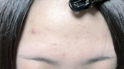 メルライン/リアルビューティーケア/オールインワン化粧品を使ったクチコミ(2枚目)