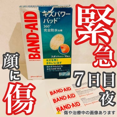 前回、キズパワーパッドを貼ってから
3日経ったので、傷口チェックです🔍

＊＊＊＊＊＊♪＊＊＊＊♪＊＊
■バンドエイド キズパワーパッド
　スポットタイプ

貼る位置や洗顔時にめちゃくちゃ気をつけたので