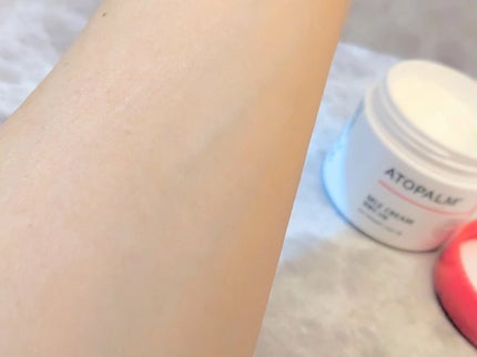 アトパーム MLE クリーム/ATOPALM/フェイスクリームを使ったクチコミ(5枚目)