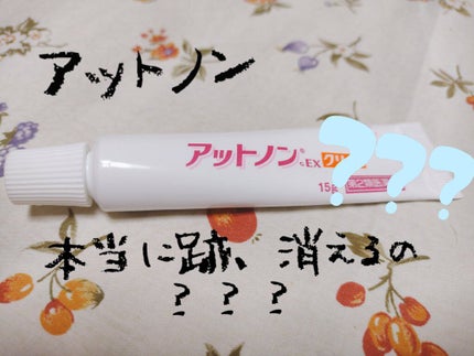 アットノンEX クリーム(医薬品)/アットノン/その他を使ったクチコミ(1枚目)