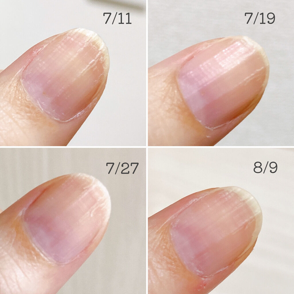 ネイリッチ/DHC/健康サプリメントを使ったクチコミ（3枚目）