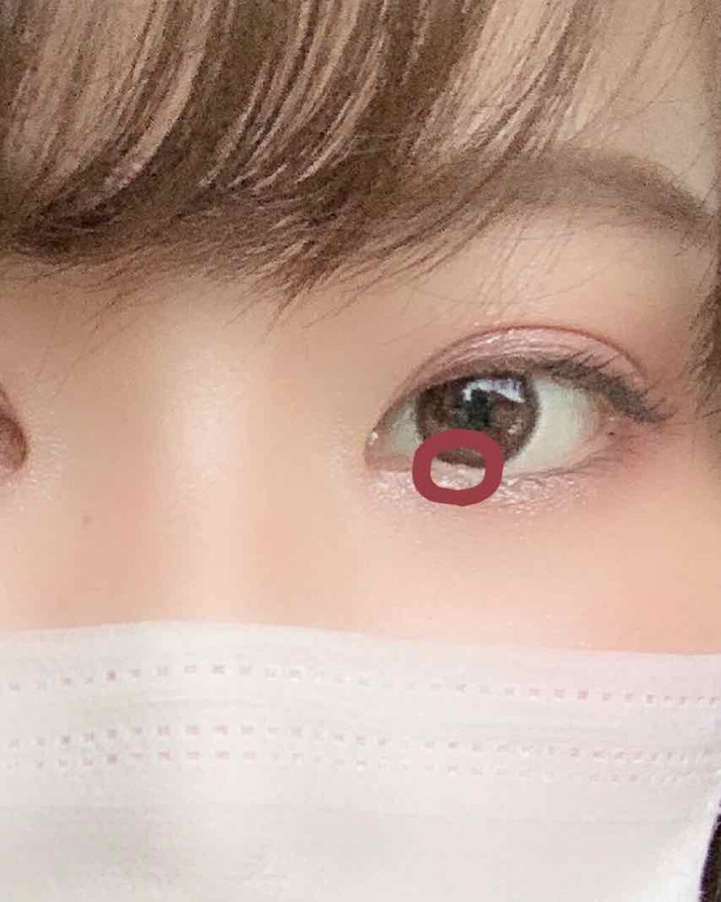 しゃけおにぎり on LIPS 「⚠️目に手術痕があります 苦手な方は見ないことをおすすめしま..」(2枚目)