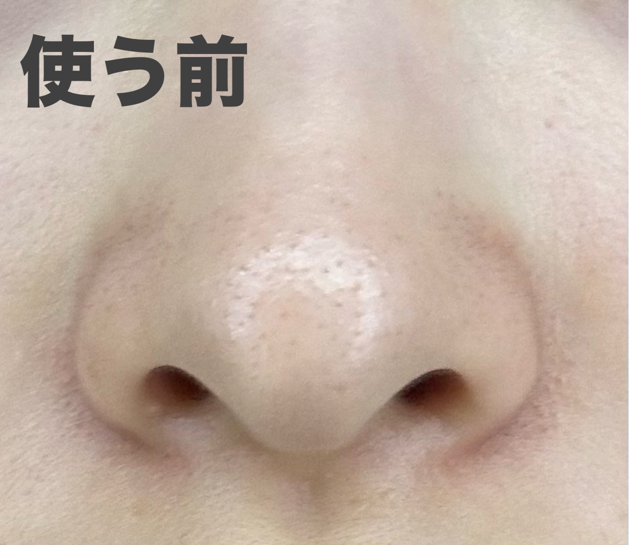 超高圧VC誘導体 クレンジングウォーター/matsukiyo/クレンジングウォーターを使ったクチコミ（3枚目）