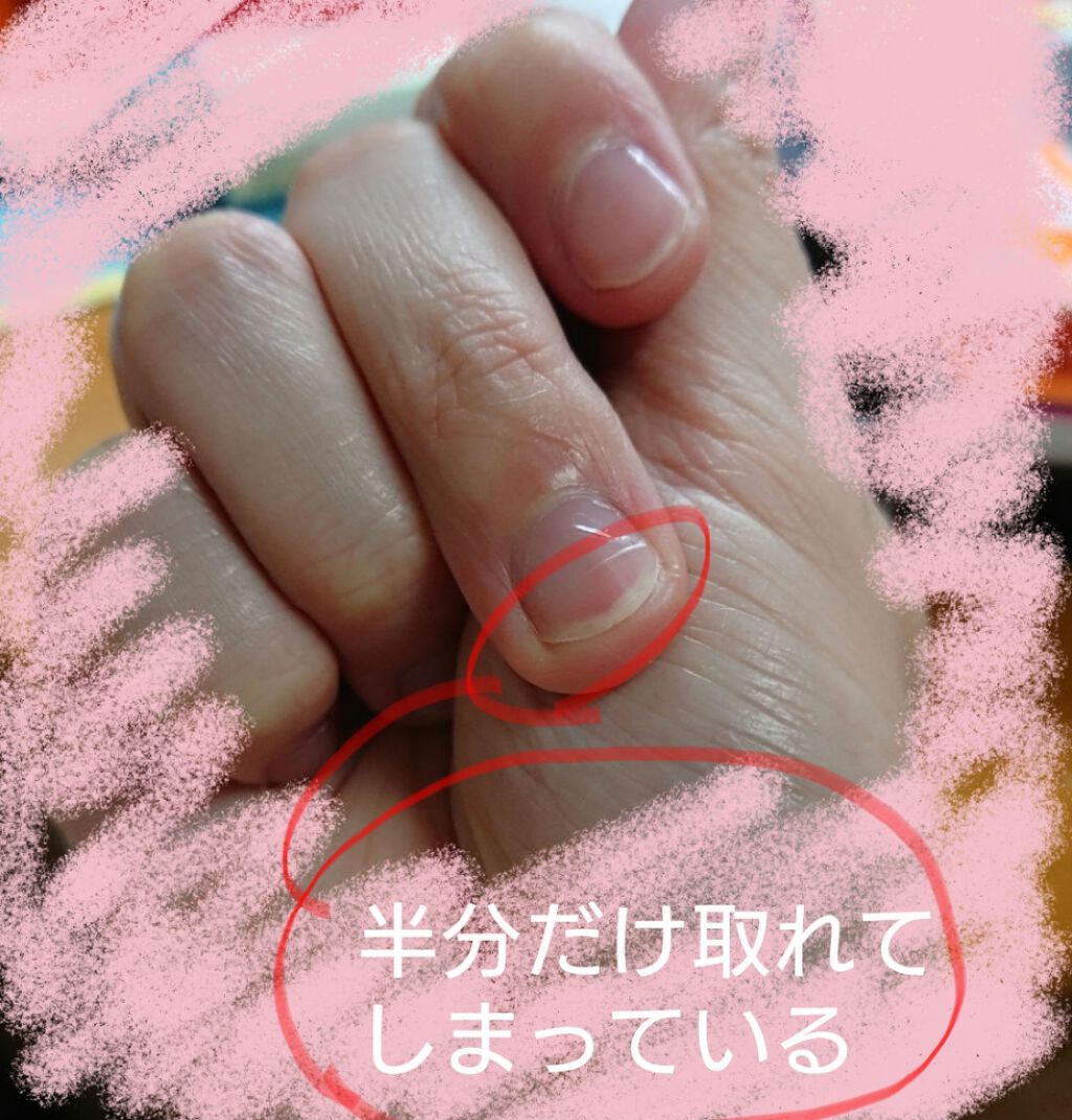 At トップ ベースコート Art Collectionの口コミ 初レビューです 至らない点もあ By ゆうきまこと 混合肌 代前半 Lips At トップ ベースコート Art Collectionの口コミ 初レビューです 至らない点もあ By ゆうきまこと 混合肌 代前半 Lips