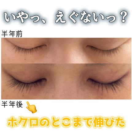 スカルプD ボーテ ピュアフリーアイラッシュセラム/アンファー(スカルプD)/まつげ美容液を使ったクチコミ(2枚目)
