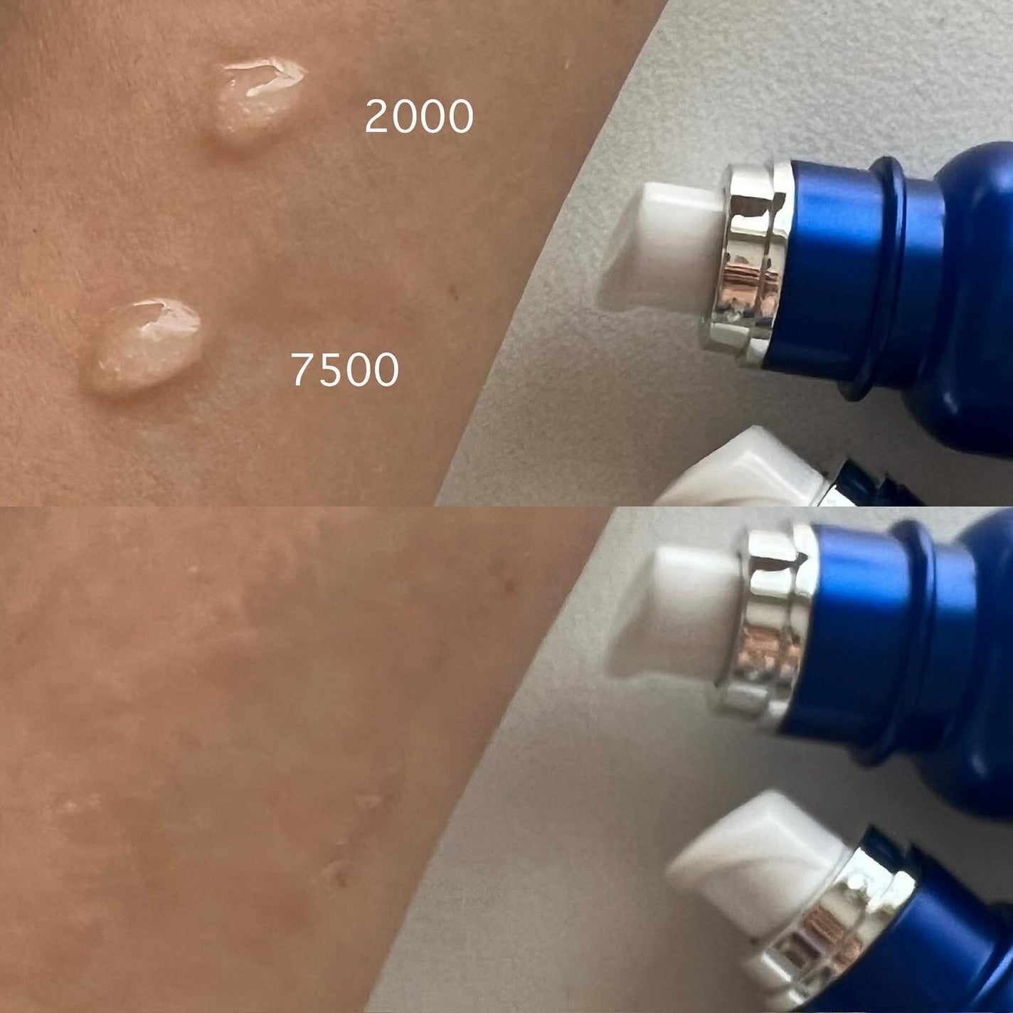 chimmy on LIPS 「━━━━━━━━━━━━━━━━medicube毛穴ごっそりセ..」(6枚目)