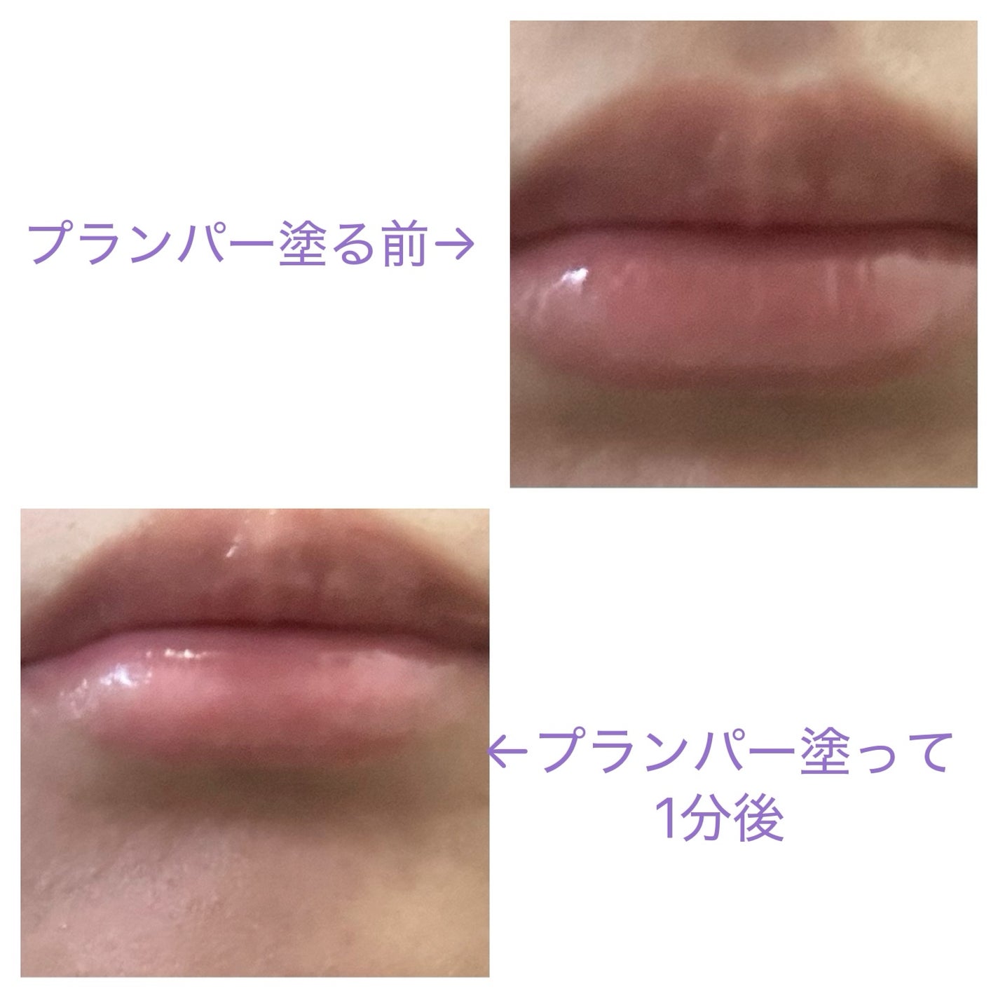 ボリュームリッププランパー/BANILA CO/リッププランパーを使ったクチコミ(2枚目)