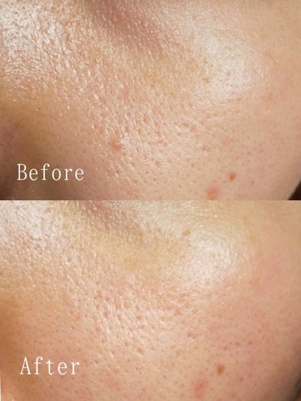 ネイチャーコンク 薬用クリアモイストジェルクリーム/ネイチャーコンク/オールインワン化粧品を使ったクチコミ(2枚目)