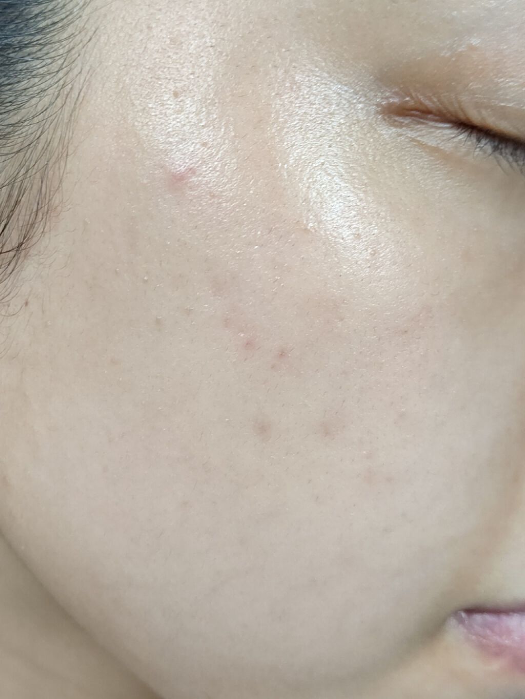 オードムーゲ 薬用ローション（ふきとり化粧水）/オードムーゲ/拭き取り化粧水を使ったクチコミ（3枚目）