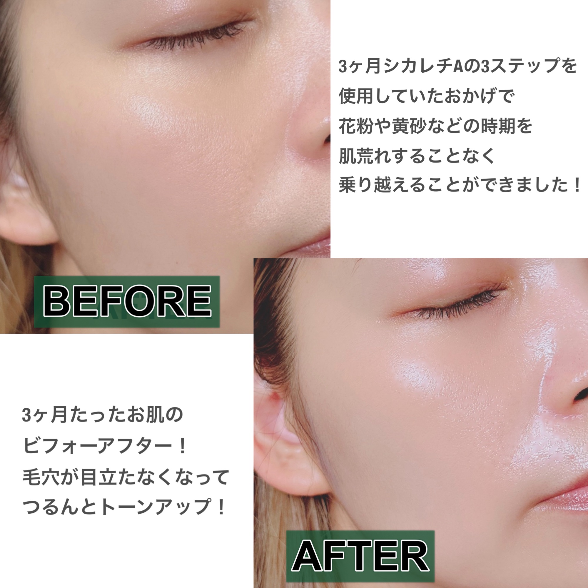 シカレチA エッセンス0.1/VT/美容液を使ったクチコミ（3枚目）