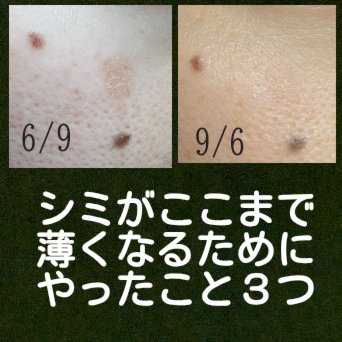 ハイドロクリームPHQ-8/KISO/美容液を使ったクチコミ（1枚目）