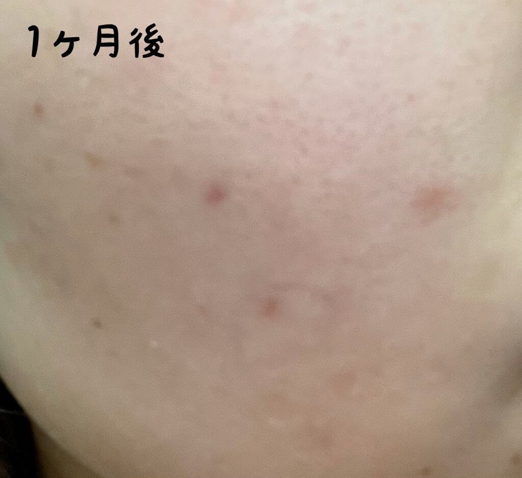 ハイドロクリーム SHQ-10/KISO/フェイスクリームを使ったクチコミ(4枚目)