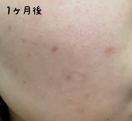 ハイドロクリーム SHQ-10/KISO/フェイスクリームを使ったクチコミ(4枚目)