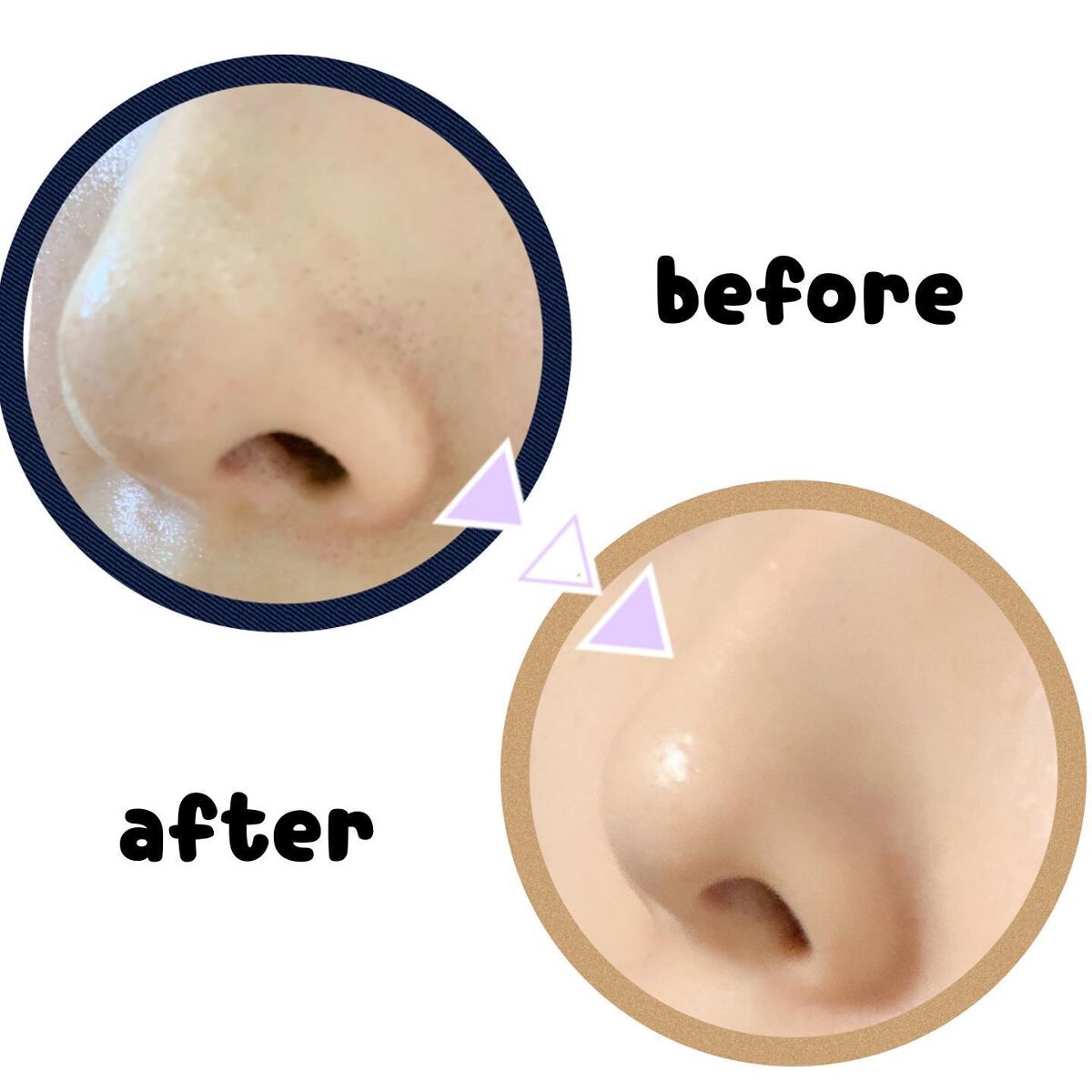 chichannnnð§žãã©ãã100 on LIPS ãâ©â/ããŒããã®ç±³ã¬ãã®ããã¯ãé±3å䜿ãç¶ããŠã¿ããâ¡ïž/ã..ãïŒ2æç®ïŒ