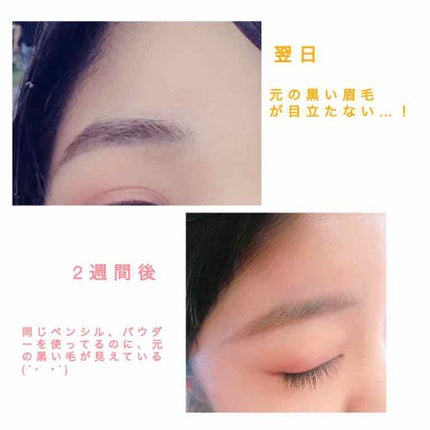 脱色クリーム 敏感肌用/エピラット/ムダ毛ケアを使ったクチコミ(2枚目)