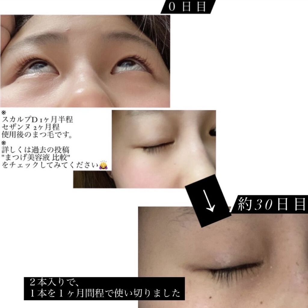 ラララッシュ まつげ美容液/合同会社M&M/まつげ美容液を使ったクチコミ（2枚目）