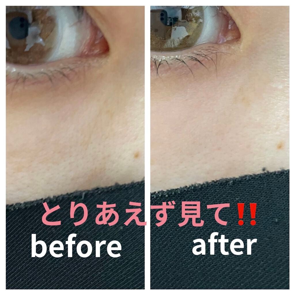 スキンライトセラピーII/Makeon/美顔器・マッサージを使ったクチコミ(1枚目)