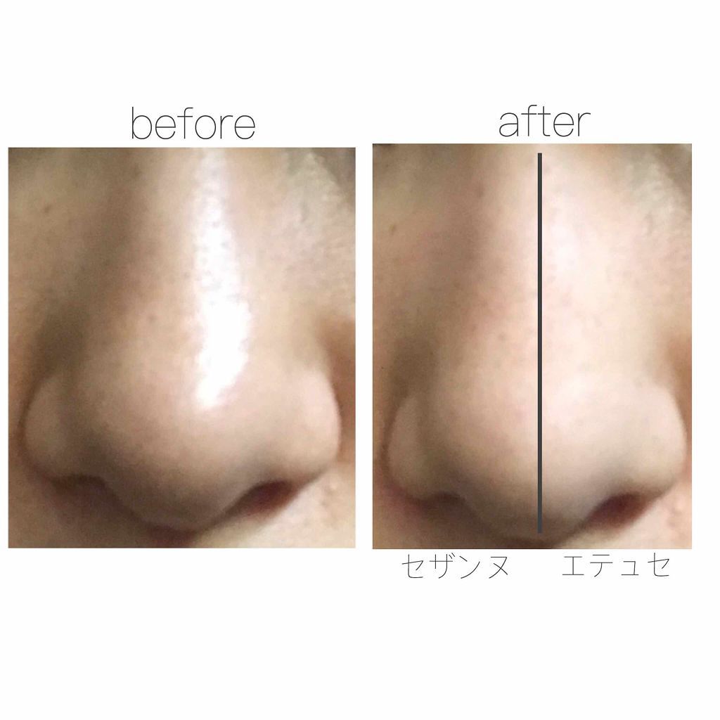 エテュセ ポアレスプライマー/ettusais/化粧下地を使ったクチコミ（3枚目）