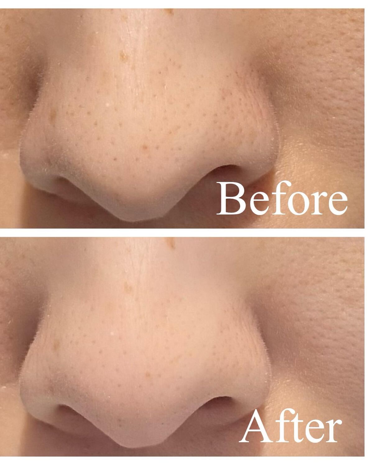 リードルショット100/VT/美容液を使ったクチコミ(3枚目)