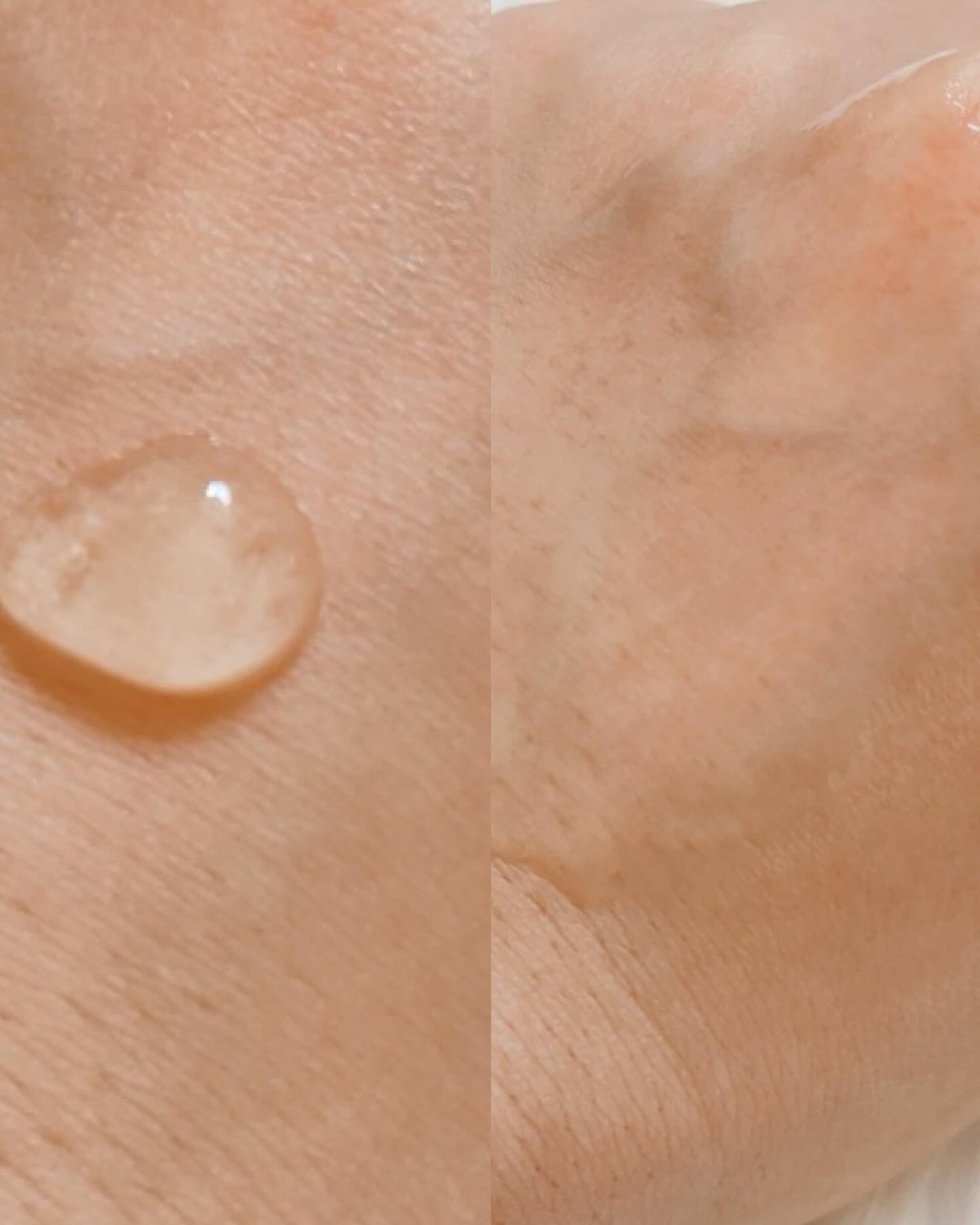 シカテロル スポットマスクパッド/beplain/トナーパッドを使ったクチコミ(6枚目)