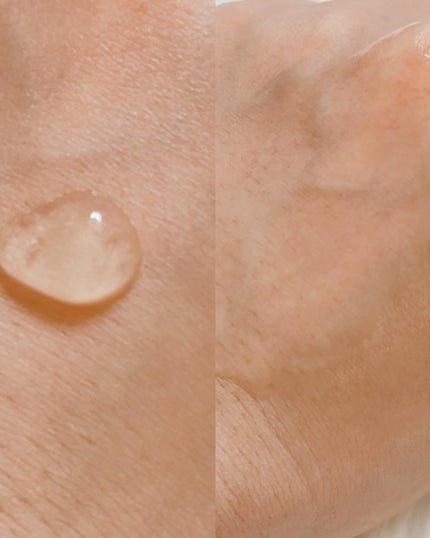 シカテロル スポットマスクパッド/beplain/トナーパッドを使ったクチコミ(6枚目)