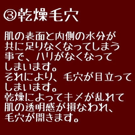 リアルカレンデュラピールオフパック/APRILSKIN/ピーリングを使ったクチコミ(4枚目)